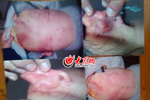 　山東藝術(shù)設(shè)計(jì)學(xué)院16歲女生宿舍內(nèi)被女同學(xué)暴打4小時(shí)。