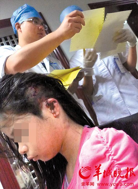 受傷的11歲女孩頭發(fā)被卷入扶梯，耳朵被嚴(yán)重拉傷，需手術(shù)。