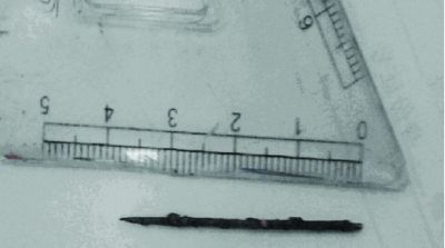 取出的繡花針已發(fā)黑生銹。