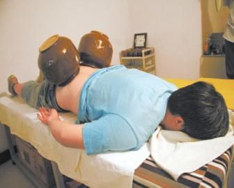 拔泡菜壇子火罐。