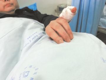 實習醫(yī)生陳洪左手的小拇指肌腱斷裂。