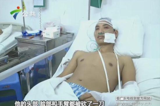 另一名傷者頭部、臉部和手臂都被砍了一刀。(視頻截圖)