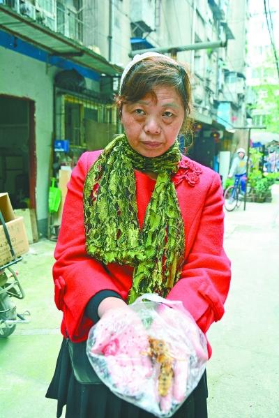 頭部受傷的黃女士展示兩根大魚刺。