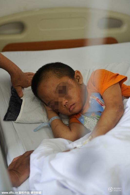 圖為全身傷痕累累的小進(jìn)。