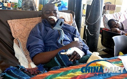 雖然已經(jīng)在醫(yī)院接受了近一個(gè)月的恢復(fù)治療，卡托卡的身體仍然非常虛弱。