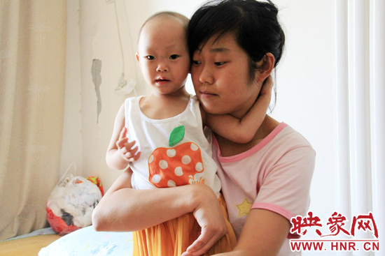 孩子和媽媽在一起，她的右眼已經(jīng)失明。