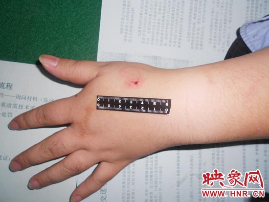 為幫助無(wú)證駕駛的朋友逃避處罰，新鄉(xiāng)的王某竟對(duì)執(zhí)勤民警大打出手，還將一名民警的手臂咬傷