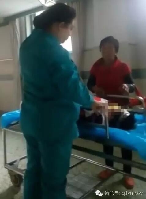 涵涵爸爸告訴《每日新聞》記者：“沒(méi)想到是熱水，大人也沒(méi)看，一時(shí)疏忽，掉進(jìn)去了。抱出來(lái)的時(shí)候這個(gè)皮已經(jīng)掉了。”