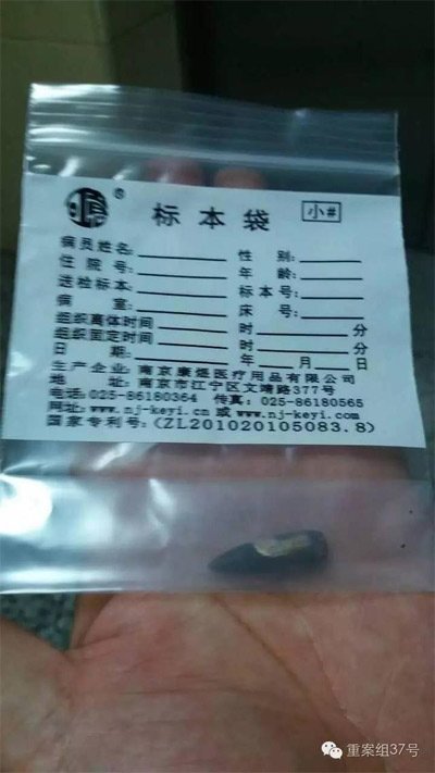 經警方鑒定，秦女士體內取出的子彈系56式步槍射出 。 受訪者供圖