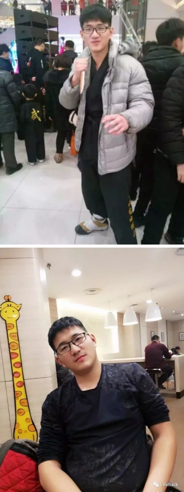 長胖20斤，臉型怎么變？這些例子看完扎心了！