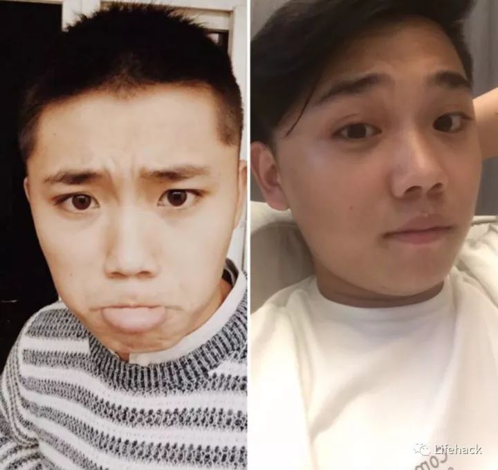 長胖20斤，臉型怎么變？這些例子看完扎心了！