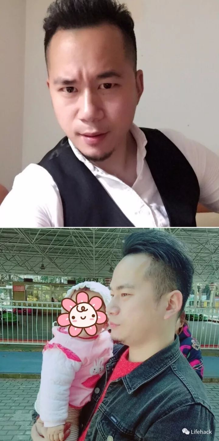 長胖20斤，臉型怎么變？這些例子看完扎心了！