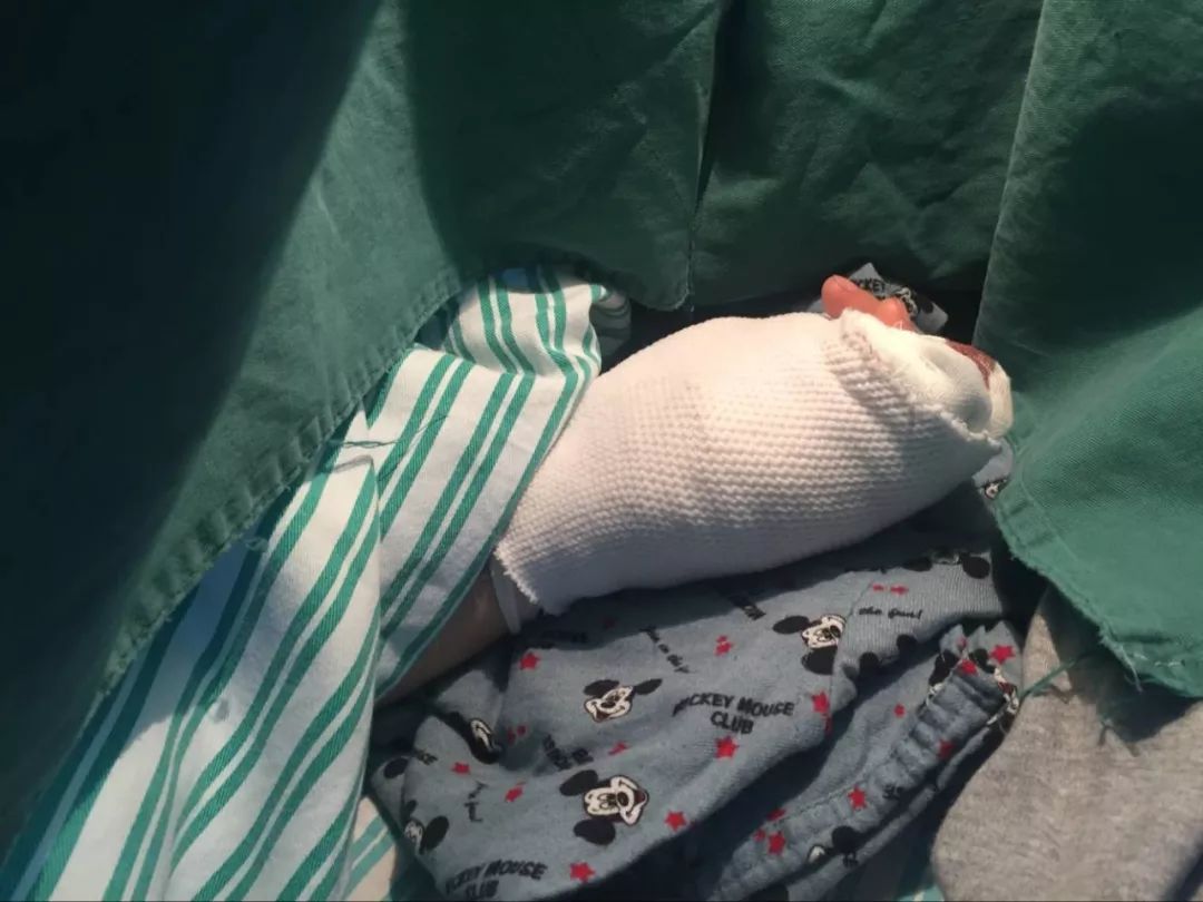 嚇哭！6歲男孩被夾斷手指 罪魁禍首竟是校服