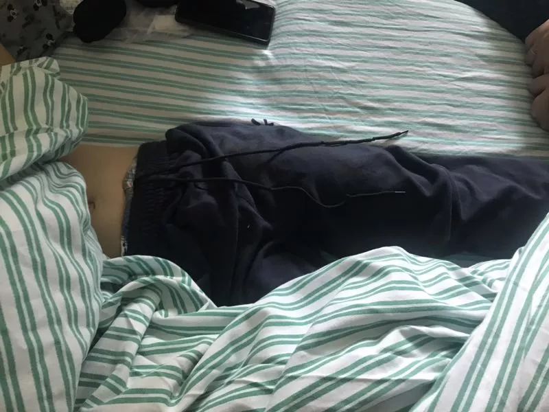 嚇哭！6歲男孩被夾斷手指 罪魁禍首竟是校服