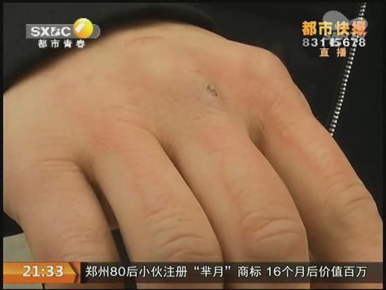 說到這足療拔罐，估計(jì)大伙都不陌生，但是想起4號(hào)晚上的拔罐的經(jīng)歷，呂先生現(xiàn)在想起來，還心有余悸。