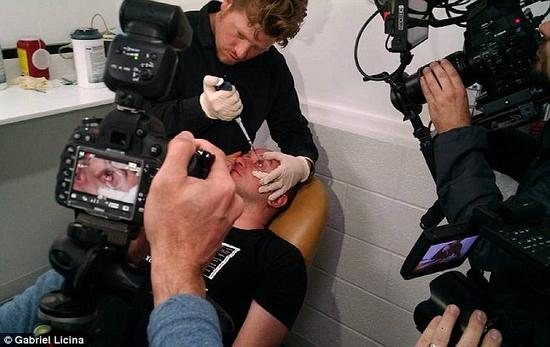 該實驗是由加州一支名為“生物駭客”的實驗團隊開展的。他們使用了一種名為二氫卟吩e6（Ce6）的物質的溶液。Ce6常見于深海魚體內，有光敏特性，通常用于癌癥治療研究中。研究團隊將Ce6與胰島素和鹽水混合起來，得到一種溶液，可以在低光照條件下提高人類的視力。