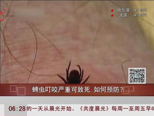 蜱蟲叮咬嚴(yán)重可致死如何預(yù)防？