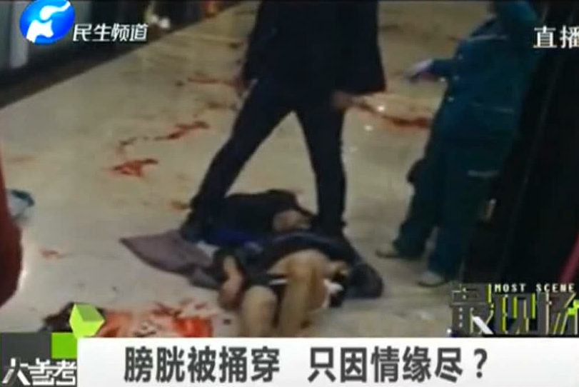 膀胱被捅穿 只因情緣盡？